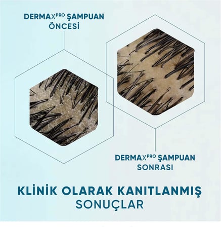 DermaXPro Yatıştırıcı Kepek Karşıtı Şampuan Kuru ve Kaşıntılı Saç Derisi için 300 ML