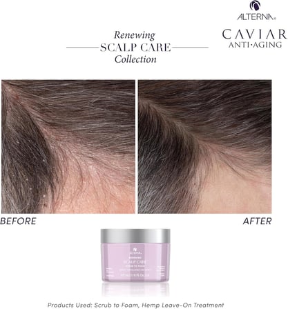 Caviar Renewing Scalp Care Scrub To Foam