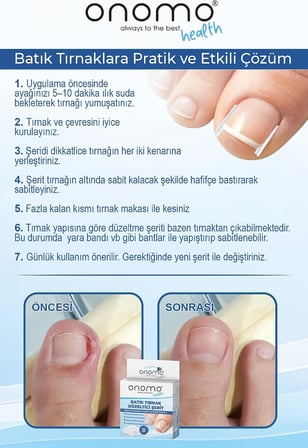 Health Batık Tırnak Düzeltici Şerit 10 Adet