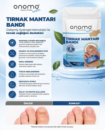 Tırnak Mantarı Bandı, Hidrojel Tırnak Bakımı 5 Adet