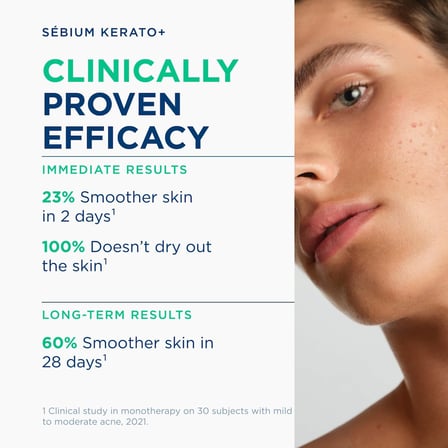 Bioderma Sébium Kerato Sivilce ve Akne Lekesi Karşıtı AHA, BHA, Salisilik Asit İçeren Bakım Kremi 30 ml