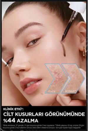 Aha+Bha Cilt Kusurları Karşıtı Siyah Serum %4 [Niasinamid+Peeling Etkili Aha+Bha] 30ml