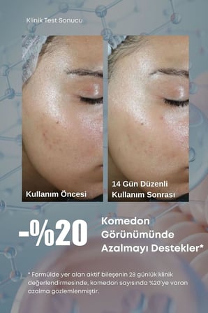 Retinol-Ish Serum