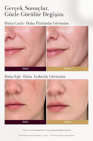 Leke Karşıtı ve Aydınlatıcı C Vitamini Serum 30ML | Arbutin, Tranexamic Asit, Niacinamide, Hyalüronik Asit - Gözenek Sıkılaştırıcı Etki