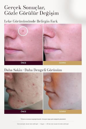Leke Karşıtı ve Aydınlatıcı C Vitamini Serum 30ML | Arbutin, Tranexamic Asit, Niacinamide, Hyalüronik Asit - Gözenek Sıkılaştırıcı Etki