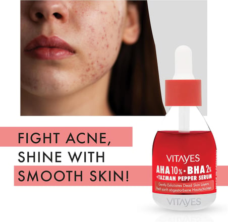 AHA%10 BHA%2 Kırmızı Peeling Cilt Serumu - Gözenek Sıkılaştırıcı, Cilt Canlandırıcı, Yenileyici, Ton Eşitleyici, Arındırıcı, Siyah Nokta ve Akne Karşıtı, Anti-Aging, Yaşlanma Karşıtı 30 ml