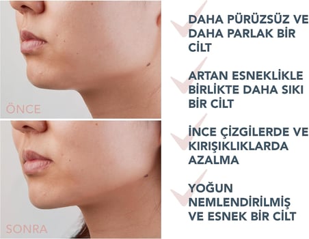 Supercharged sıkılaştırıcı serum, üç kat etkili – iletken jel – hiyalüronik asit ve skualan – yüz nemlendirici serum – vegan ve hayvanlar üzerinde denenmemiştir – tüm cilt tipleri – 30 ml