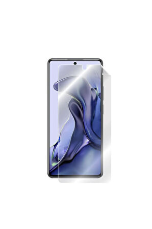 Xiaomi 11t - Mi 11t Görünmez Hydrogel Ekran Koruyucu