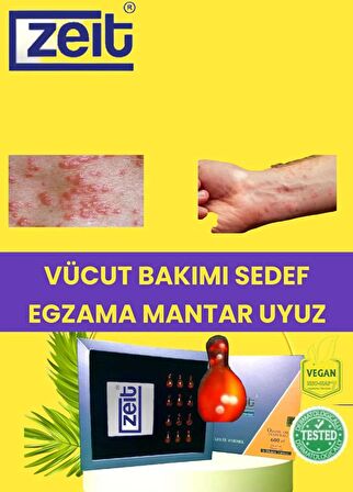 Uyuz Ve Kaşıntı Kremi Doğal Nemlendirici Vücut Bakım Losyonu Aktif Ozon yağı Kapsülleri 12 li