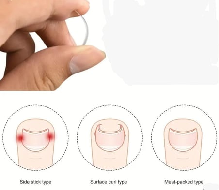 Özel Üretim Bakım Rutini Gelişmiş Alet Ayak Bakımı Paslanmaz Çelik Ergonomik Tırnak Düzeltici Seti