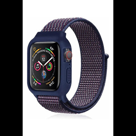 Newface Apple Uyumlu Watch 38mm Hasırlı Cırtcırtlı Kasalı Kordon