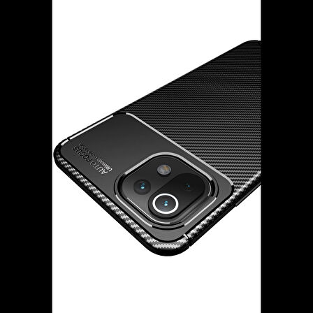 Newface Xiaomi Uyumlu Mİ 11 Lite Kılıf Auto Focus Karbon Kapak