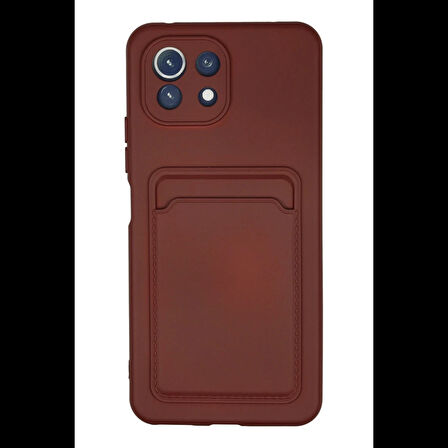 Newface Xiaomi Mİ 11 Lite Kılıf Kelvin Kartvizitli Silikon