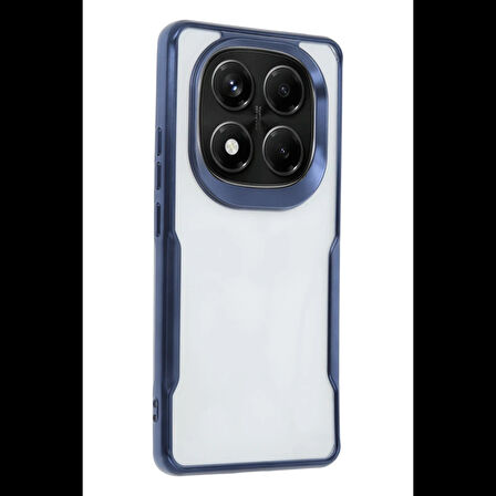 Newface Xiaomi Redmi Note 14 Pro Plus Kılıf Boyi Silikon Kapak