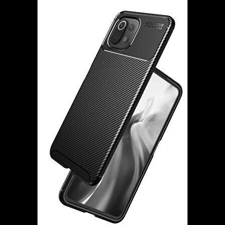Newface Xiaomi Uyumlu Mİ 11 Lite Kılıf Auto Focus Karbon Kapak