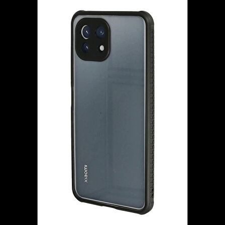 Newface Xiaomi Mİ 11 Lite Kılıf Miami Şeffaf Silikon