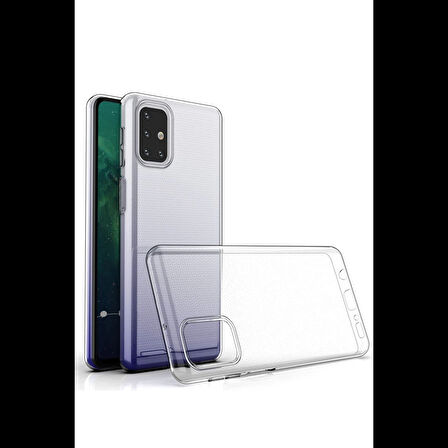 Newface Samsung Galaxy M31S Kılıf Lüx Şeffaf Silikon