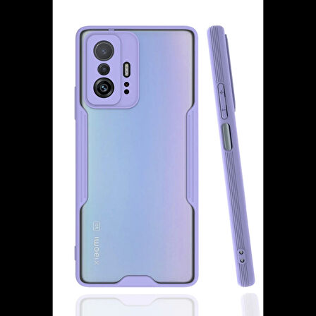 Newface Xiaomi Mi 11T Pro Kılıf Platin Silikon