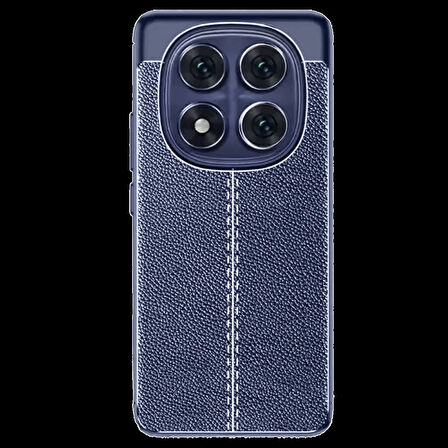 Joy Tekno Xiaomi Redmi Note 14 Pro 4G Kılıf Auto Focus Kapak