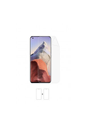 Xiaomi Mi 11 Ultra Ekran Koruyucu Kaplama Darbe Emici Poliüretan Film Amerika Üretimi