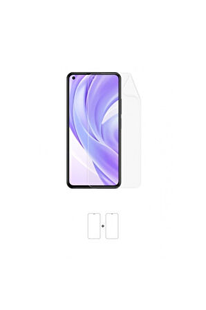 Xiaomi Mi 11 Lite Ekran Koruyucu Kaplama Darbe Emici Poliüretan Film Amerika Üretimi