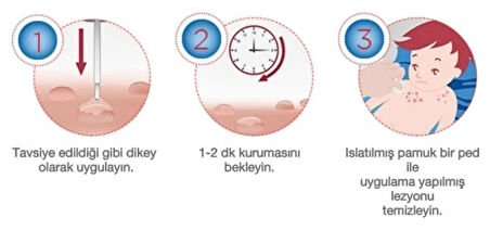 Molusk Dermal Solüsyon 3Gr