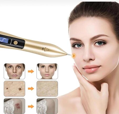 Profesyonel 9 Kademe Dijital Laser Plazma Pen Gold Renk Ben, Siğil Ve Leke Cihazı