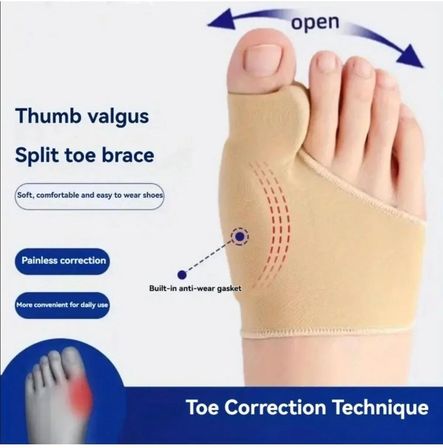 Silikon Destekli / Yastıklı Halluks Valgus İzolasyon Jel Ayak Koruyucu – Ayak Parmak Ayırıcı | Yumuşak Bunion Düzeltici | Parmak Hizalama ve Günlük Konfor Desteği 1 ÇİFT BEDEN : M (35-38)