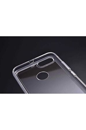 Xiaomi Mi 5x Uyumlu Kılıf Gard Silikon