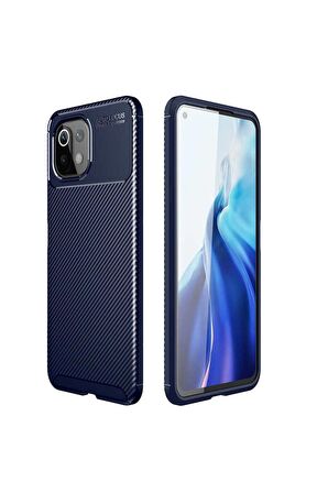 Xiaomi Mi 11 Lite Uyumlu Kılıf Negro Silikon Kapak Lacivert