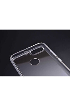 Xiaomi Mi 5x Uyumlu Kılıf Zore Gard Silikon