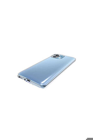 Xiaomi Mi 11 Uyumlu Kılıf Zore Süper Silikon Kapak