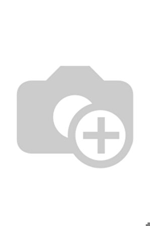 Xiaomi Redmi Note 11 Pro 5G Uyumlu Davin Mat Seramik Ekran Koruyucu