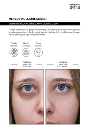 Gözaltı Morluk,Koyu Halka ve Torbalanma Karşıtı Caffeine Ampoule Serum 50 ml