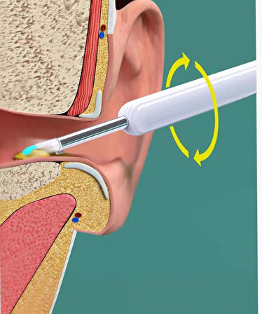 Kameralı Kulak Temizleme Cihazı şarjlı endoskobik ( androıd ve ios telefon uyumlu )
