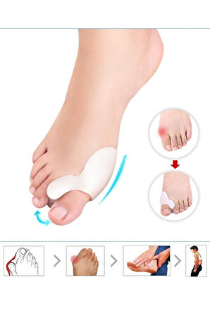 Ayak Başparmak Kemik Koruyucu Halluks Valgus Parmak Koruyucu Kemik Çıkıntısı Önleyici