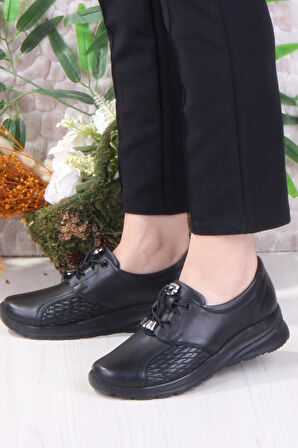 Mehmet Mete 42041 Kemik Çıkıntısına Özel Lastik Bağcıklı Hakiki Deri Kadın Ayakkabı