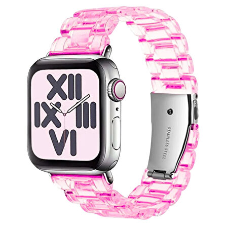 Nettech Apple Watch Series 2 38 mm Uyumlu Kasa Korumalı Kordon NT-112408