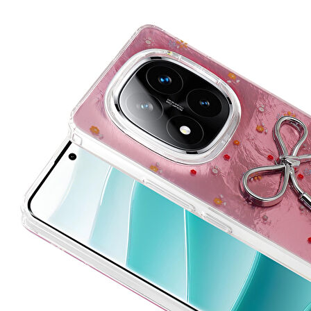 Redmi Note 14 Pro Plus Kılıf Kamera Korumalı Figürlü Zore Ponti Silikon Kapak - Açık Mavi