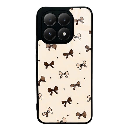 Xiaomi 15T Kılıf Kamera Lens Korumalı Desenli Silikon Üstün Koruma Nourth