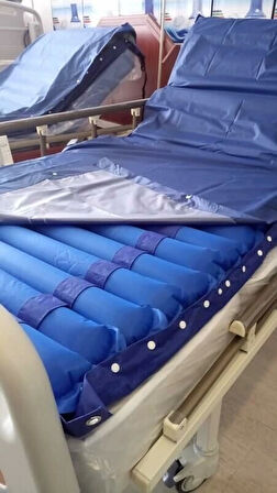 Witra Boru Tipi Havalı Yatak 8 cm | A+B Sistem, Terleme Önleyici ve Konforlu