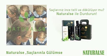 Naturalse Saç Dökülmesine Karşı %100 Bitkisel Sprey Serum 100ml Saç Gürleştirici - Besleyici - Onarıcı