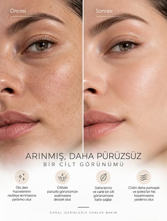 Peeling - Özel Granüllü