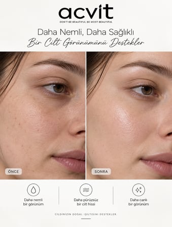 Acvit Hydra Milk 8d Hyaluronik Asit Nemlendirici Serum 30 ml | Yoğun Nem & Bariyer Güçlendirici
