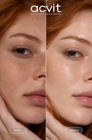 Acvit Işıltı 18 Bisabolol Aydınlatıcı Serum 30 ml | Leke Karşıtı & Cilt Tonu Eşitleyici & Işıltı Veren