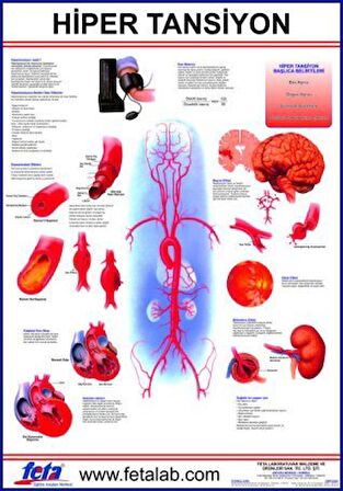 Hipertansiyon Eğitim Plakası