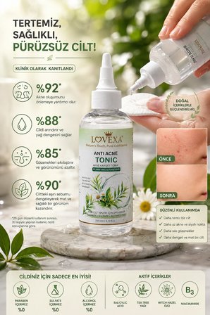 LOVEXA ANTİ ACNE TONİC SEBUM DENGELEYİCİ