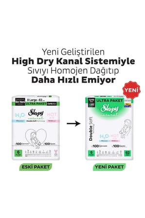 Sleepy Natural Double Soft Avantajlı Mega Paket Bebek Bezi 6 Numara Xlarge 80 Adet