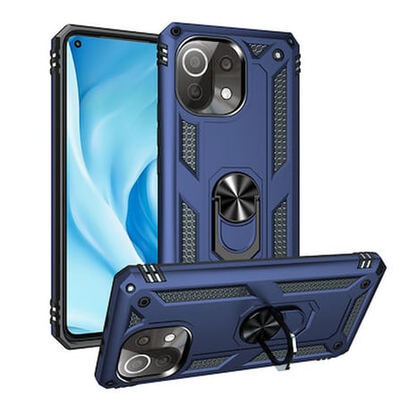 Lexroo Xiaomi Mi 11 Lite Vega TPU Silikon Sert PC İnce Kılıf - Siyah