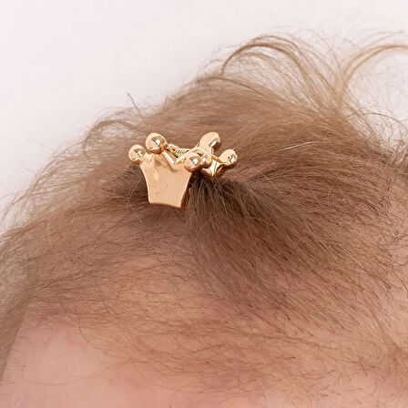 HelloBaby Kız Bebek Toka